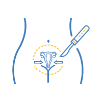 Vaginoplasty